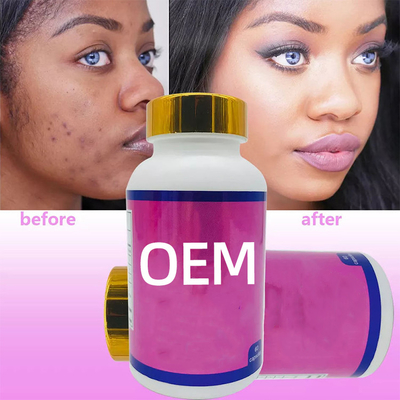 OEM Glutathion Hautbleichmittel 60 Stück/Soft Gel